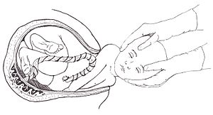 English: Childbirth scientific illustration. B...