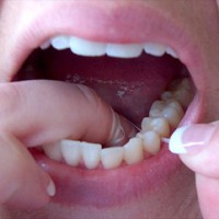 How Can A Dentist Prevent Teeth and Gum Problems?