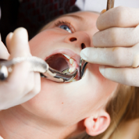 teeth extraction