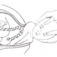 Childbirth.norarte